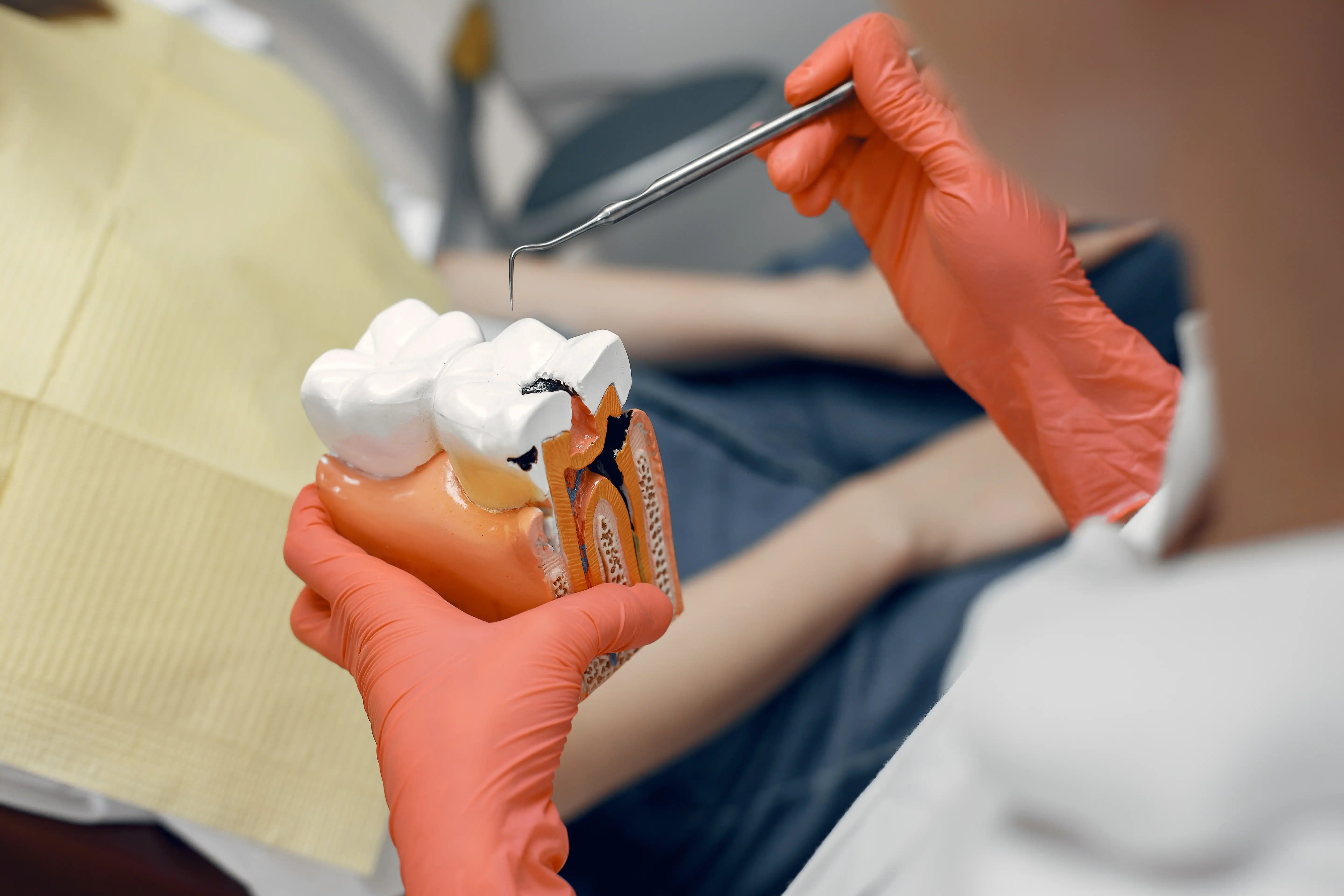 Which Dental Procedure Hurts More: Root Canal or Wisdom Tooth Extraction